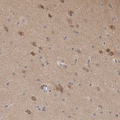 Anti-SCRN1 antibody produced in rabbit affinity isolated antibody, buffered aqueous glycerol solution