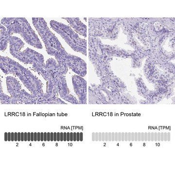 Anti-LRRC18 antibody produced in rabbit Prestige Antibodies&#174; Powered by Atlas Antibodies, affinity isolated antibody, buffered aqueous glycerol solution