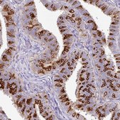 Anti-AGR3 antibody produced in rabbit Prestige Antibodies&#174; Powered by Atlas Antibodies, affinity isolated antibody, buffered aqueous glycerol solution