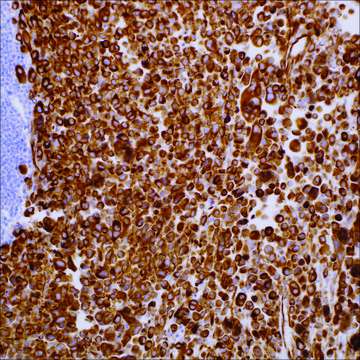 Nestin (10C2) Mouse Monoclonal Antibody