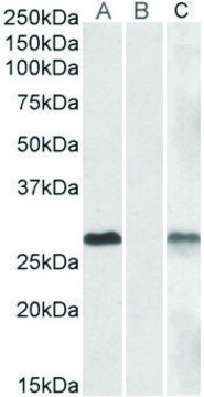 Anti-DYDC1 antibody produced in goat affinity isolated antibody, buffered aqueous solution