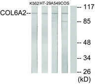 Anti-Collagen VI &#945;2 antibody produced in rabbit affinity isolated antibody