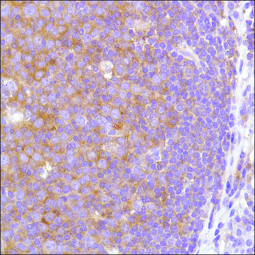 Anti-VPAC2 antibody, Rabbit monoclonal recombinant, expressed in proprietary host, clone SP235, affinity isolated antibody