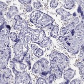 Anti-TSHB antibody produced in rabbit Prestige Antibodies&#174; Powered by Atlas Antibodies, affinity isolated antibody
