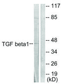 Anti-TGF &#946;1 antibody produced in rabbit affinity isolated antibody
