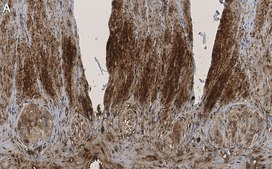 Anti-phospho-HSP27 Ser82 Antibody, clone 1O17 ZooMAb&#174; Rabbit Monoclonal recombinant, expressed in HEK 293 cells