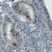 Monoclonal Anti-MKI67 antibody produced in mouse Prestige Antibodies&#174; Powered by Atlas Antibodies, clone CL1234, purified immunoglobulin, buffered aqueous glycerol solution