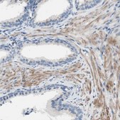 Anti-FDFT1 antibody produced in rabbit affinity isolated antibody, buffered aqueous glycerol solution