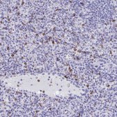 Anti-CD7 antibody produced in rabbit Prestige Antibodies&#174; Powered by Atlas Antibodies, affinity isolated antibody, buffered aqueous glycerol solution