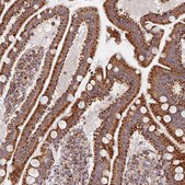 Anti-MAVS antibody produced in rabbit Prestige Antibodies&#174; Powered by Atlas Antibodies, affinity isolated antibody, buffered aqueous glycerol solution