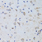 Anti-PTPN1 antibody produced in rabbit