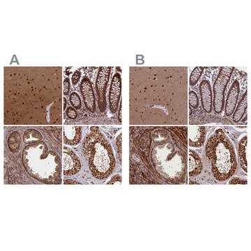 Anti-NAE1 antibody produced in rabbit Prestige Antibodies&#174; Powered by Atlas Antibodies, affinity isolated antibody, buffered aqueous glycerol solution