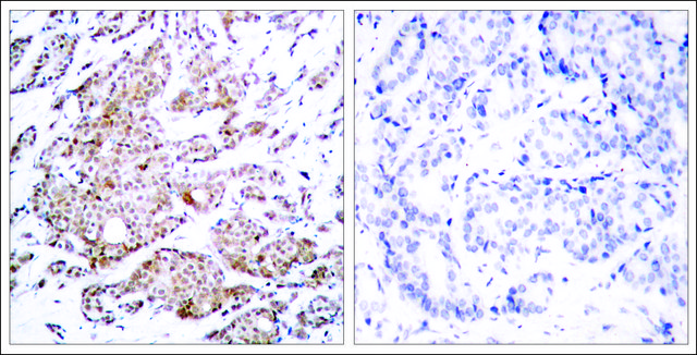 Anti-phospho-MYC (pThr58) antibody produced in rabbit affinity isolated antibody