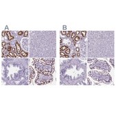 Anti-CUBN Prestige Antibodies&#174; Powered by Atlas Antibodies, affinity isolated antibody