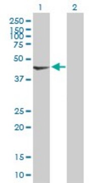 Anti-PDK2 antibody produced in mouse purified immunoglobulin, buffered aqueous solution