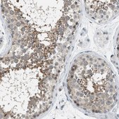 Anti-TTBK2 antibody produced in rabbit Prestige Antibodies&#174; Powered by Atlas Antibodies, affinity isolated antibody, buffered aqueous glycerol solution