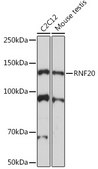 Anti-RNF20 Antibody, clone 8N4O8, Rabbit Monoclonal