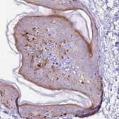 Anti-NCK2 antibody produced in rabbit Prestige Antibodies&#174; Powered by Atlas Antibodies, affinity isolated antibody, buffered aqueous glycerol solution