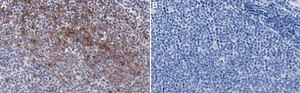 Anti-TGFBR2 Antibody, clone 1N11 ZooMAb&#174; Rabbit Monoclonal recombinant, expressed in HEK 293 cells