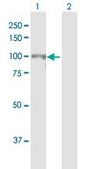 Anti-CUL4B antibody produced in mouse purified immunoglobulin, buffered aqueous solution