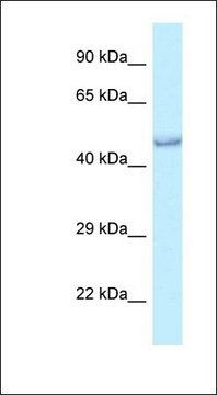 Anti-PRMT6 antibody produced in rabbit affinity isolated antibody