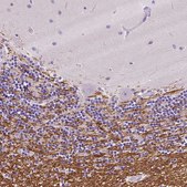 Anti-SIRT2 antibody produced in rabbit Prestige Antibodies&#174; Powered by Atlas Antibodies, affinity isolated antibody, buffered aqueous glycerol solution