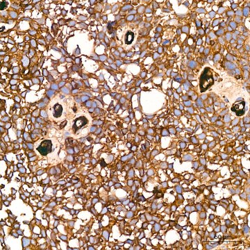 Anti-Alpha-2-Macroglobulin (A2M) Antibody, clone 7V6M10, Rabbit Monoclonal