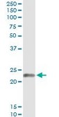 Monoclonal Anti-EDN1 antibody produced in mouse clone 3D6, purified immunoglobulin, buffered aqueous solution