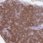 Anti-CEMP1 antibody produced in rabbit Prestige Antibodies&#174; Powered by Atlas Antibodies, affinity isolated antibody, buffered aqueous glycerol solution