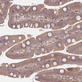 Anti-CEMP1 antibody produced in rabbit Prestige Antibodies&#174; Powered by Atlas Antibodies, affinity isolated antibody, buffered aqueous glycerol solution