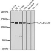 Anti-CD41/ITGA2B antibody produced in rabbit