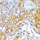 Anti-Versican antibody produced in rabbit