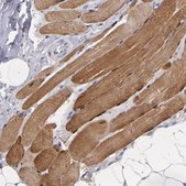 Anti-MB antibody produced in rabbit Prestige Antibodies&#174; Powered by Atlas Antibodies, affinity isolated antibody, buffered aqueous glycerol solution