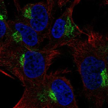 Anti-SPRY4 antibody produced in rabbit Prestige Antibodies&#174; Powered by Atlas Antibodies, affinity isolated antibody