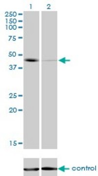 Monoclonal Anti-T antibody produced in mouse clone 5H8, purified immunoglobulin, buffered aqueous solution