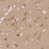Anti-ATG2B antibody produced in rabbit Prestige Antibodies&#174; Powered by Atlas Antibodies, affinity isolated antibody, buffered aqueous glycerol solution, Ab1