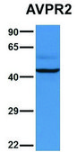 Anti-AVPR2 (C-terminal) antibody produced in rabbit affinity isolated antibody