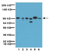 Anticorps anti-MMP-9, domaine catalytique Chemicon&#174;, from rabbit