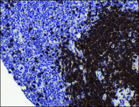 Anti-CD79A antibody, Rabbit monoclonal recombinant, expressed in proprietary host, clone SP18, tissue culture supernatant