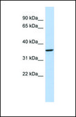 Anti-PITX3 antibody produced in rabbit affinity isolated antibody