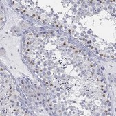 Anti-USP29 antibody produced in rabbit Prestige Antibodies&#174; Powered by Atlas Antibodies, affinity isolated antibody, buffered aqueous glycerol solution