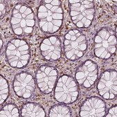 Monoclonal Anti-S100A4 antibody produced in mouse Prestige Antibodies&#174; Powered by Atlas Antibodies, clone CL0237, purified immunoglobulin, buffered aqueous glycerol solution