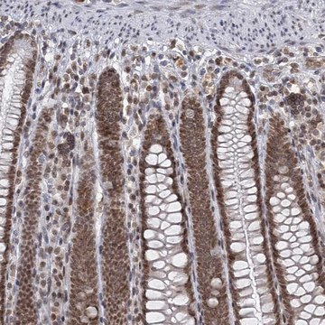 Anti-TREX1 antibody produced in rabbit Prestige Antibodies&#174; Powered by Atlas Antibodies, affinity isolated antibody, buffered aqueous glycerol solution