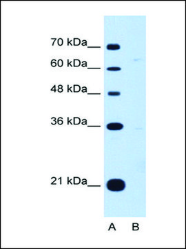 Anti-DONSON antibody produced in rabbit affinity isolated antibody