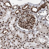 Anti-DNMT3A antibody produced in rabbit Prestige Antibodies&#174; Powered by Atlas Antibodies, affinity isolated antibody, buffered aqueous glycerol solution
