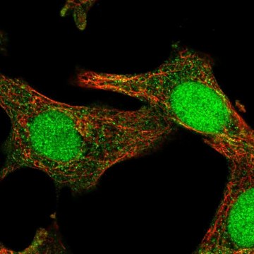 Anti-SOCS4 antibody produced in rabbit Prestige Antibodies&#174; Powered by Atlas Antibodies, affinity isolated antibody