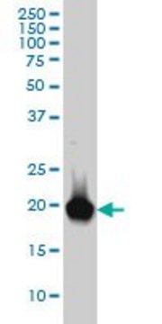 Monoclonal Anti-RBP4, (C-terminal) antibody produced in mouse clone 1E9, purified immunoglobulin, buffered aqueous solution