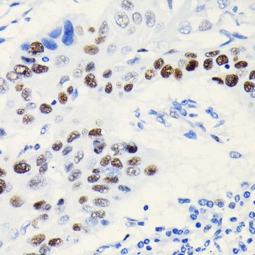 Anti-TCF4/TCF7L2 antibody produced in rabbit