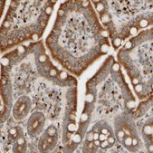 Anti-FMO1 antibody produced in rabbit Prestige Antibodies&#174; Powered by Atlas Antibodies, affinity isolated antibody, buffered aqueous glycerol solution