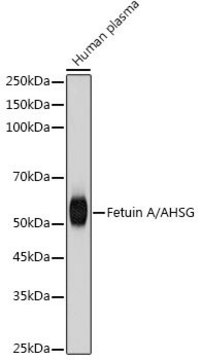 Anti-Fetuin A/AHSG antibody produced in rabbit